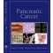 Pancreatic Cancer