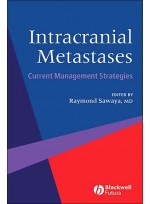 Intracranial Metastases: Current Management Strategies