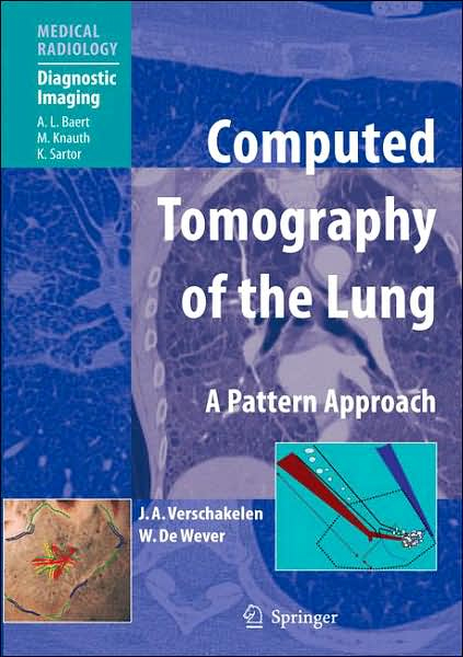 Computed Tomography of the Lung:A Pattern Approach