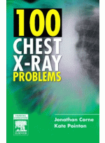 100 Chest X-Ray Problems