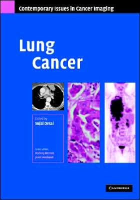 Lung Cancer