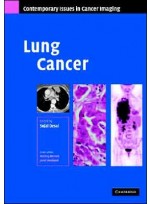 Lung Cancer