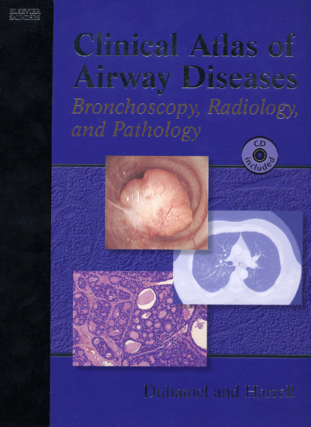 Clinical Atlas of Airway Disease - Bronchoscopy, Radiology and Pathology