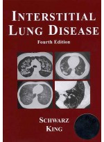 Interstitial Lung disease