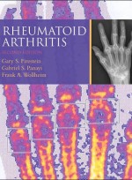 Rheumatoid Arthritis,2/e