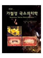 가철성 국소의치학 제4판