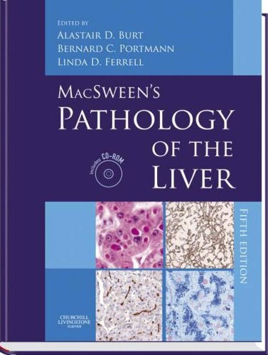 MacSween\'s Pathology of the Liver:with CD-ROM,5/e