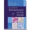 MacSween's Pathology of the Liver:with CD-ROM,5/e