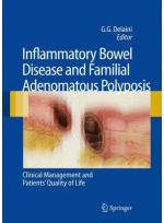 Inflammatory Bowel Disease and Familial Adenomatous Polyposis