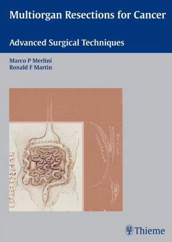 Multiorgan Resections for Cancer: Advanced Surgical Techniques