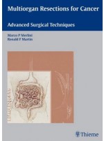 Multiorgan Resections for Cancer: Advanced Surgical Techniques