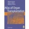 Atlas of Organ Transplantation