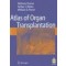 Atlas of Organ Transplantation