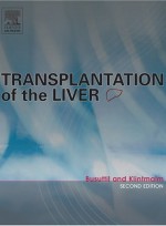 Transplantation Of The Liver , 2e