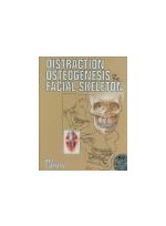 Distraction Osteogenesis of the Facial Skeleton,1/e