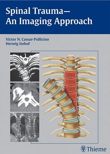 Spinal Trauma: An Imaging Approach