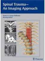 Spinal Trauma: An Imaging Approach