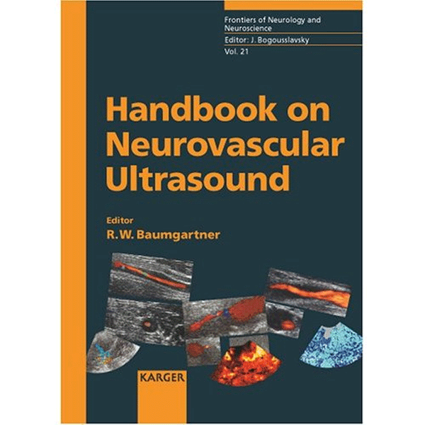 Handbook on Neurovascular Ultrasound