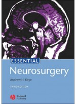 Essential Neurosurgery