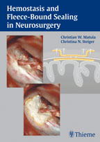 Haemostasis and Fleece-Bound Sealing in Neurosurgery