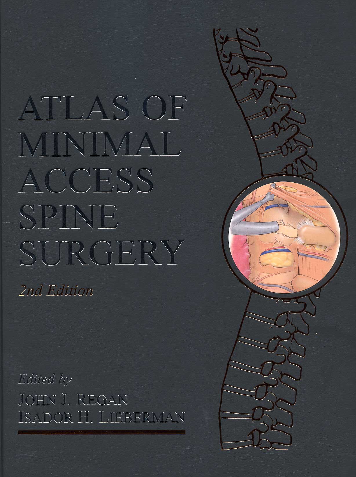 Atlas of Minimal Access Spine Surgery, 2nd edition