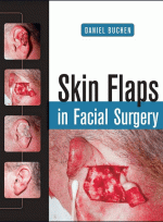 Skin Flaps in Facial Surgery