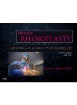 Primary Rhinoplasty with DVD, 2/e