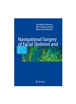 Navigational Surgery of the Facial Skeleton