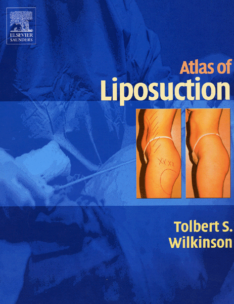 Atlas of Liposuction