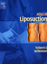 Atlas of Liposuction