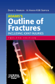 Adams’s Outline of Fractures,12/e