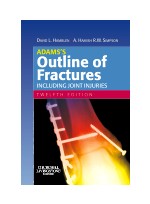 Adams’s Outline of Fractures,12/e