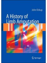 A History of Limb Amputation