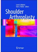 Shoulder Arthroplasty