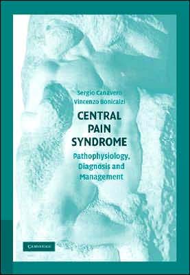 Central Pain Syndrome:Pathophysiology diagnosis & management