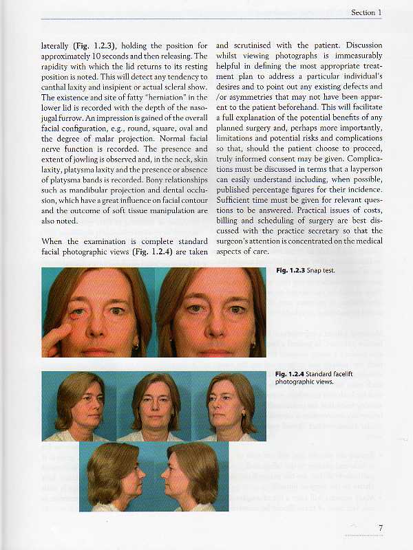 Facial Rejuvenation Surgery with DVD