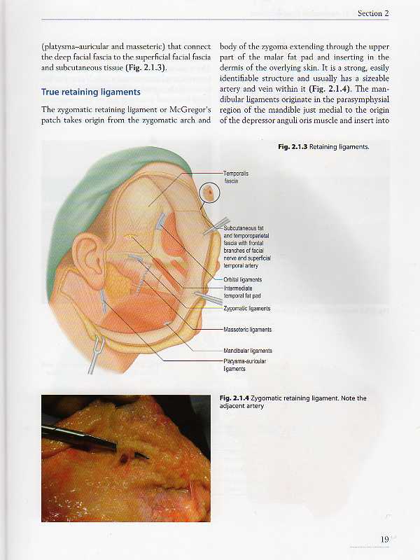 Facial Rejuvenation Surgery with DVD