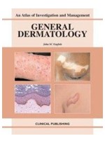 General Dermatology:An Atlas of Investigation & Management
