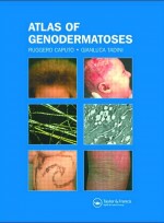 Atlas of Genodermatoses