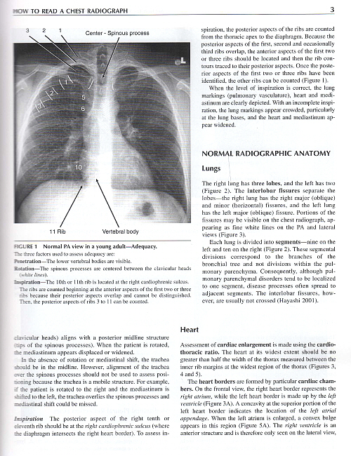 Emergency Radiology: Case Studies,1/e