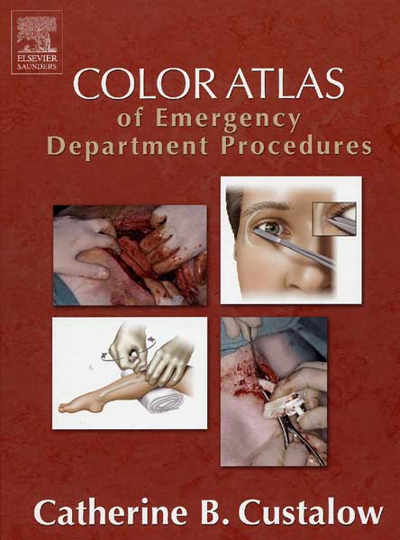 Color Atlas of Emergency Department Procedures
