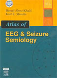 Atlas of EEG & Seizure Semiology