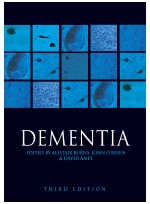 Dementia Mild Cognitive Impairment