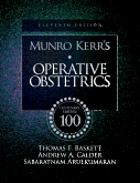 Munro Kerr\'s Operative Obstetrics,11/e