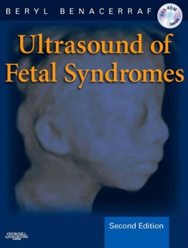 Ultrasound of Fetal Syndromes, 2/e - Text with DVD