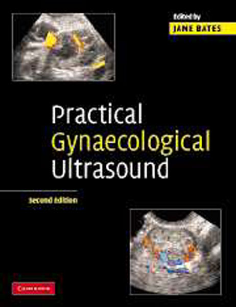Practical Gynaecological Ultrasound,2/e
