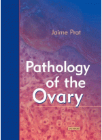 Pathology of the Ovary