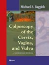 Colposcopy of the Cervix Vagina and Vulva