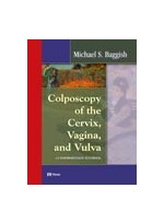 Colposcopy of the Cervix Vagina and Vulva
