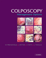 Colposcopy Management Options